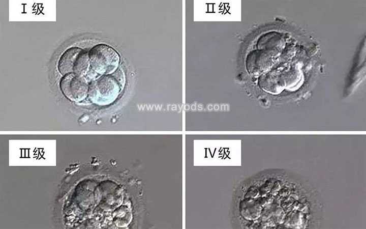 山东市供卵试管代孕机构,二代试管培养的胚胎质量怎么样？等级是多少？_杭州