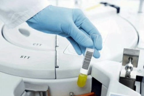 成都寻找代孕医院,成都做试管婴儿的大概费用需要多少钱？成都试管婴儿医院