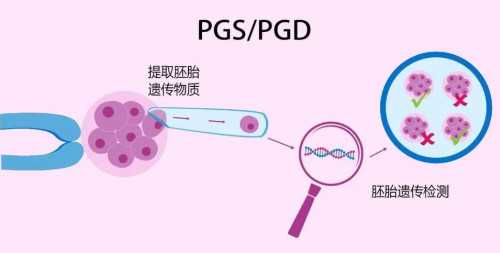 成都代怀代生孩子,北京第三代试管婴儿医院_成都试管婴儿医院成功率排名，