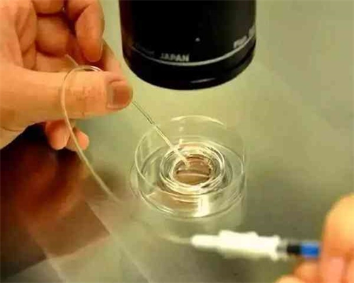 成都代生正规机构,试管婴儿后唐氏儿概率高吗？成都唐氏筛查医院费用