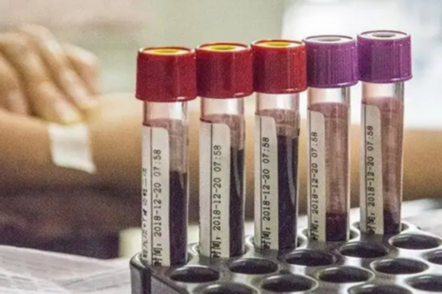 选择一家试管婴儿医院主要看哪些因素?-试管供卵代怀