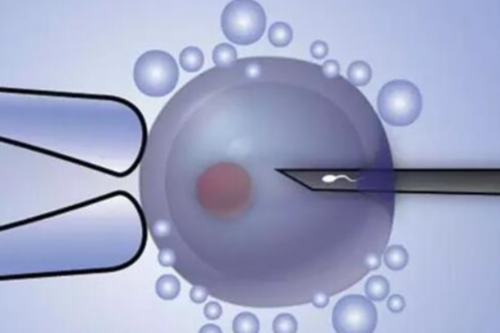 成都靠谱供卵公司,为什么成都做试管婴儿可以更轻松地好孕？