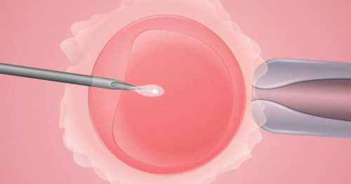 成都有专业供卵助孕吗,成都助孕机构大比拼：2026最受欢迎的8家医院排名