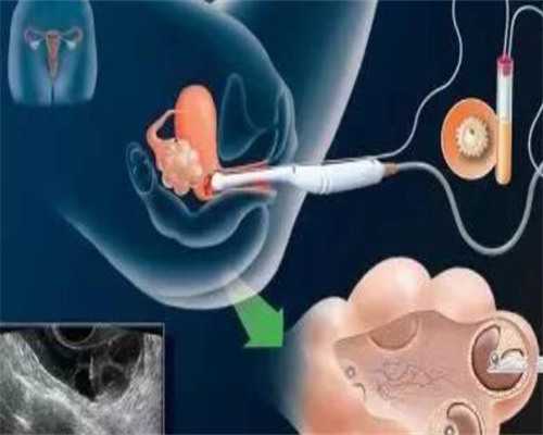 四川供卵自怀三代,眉山医院做供卵试管费用是多少，四川试管助孕的价格明细