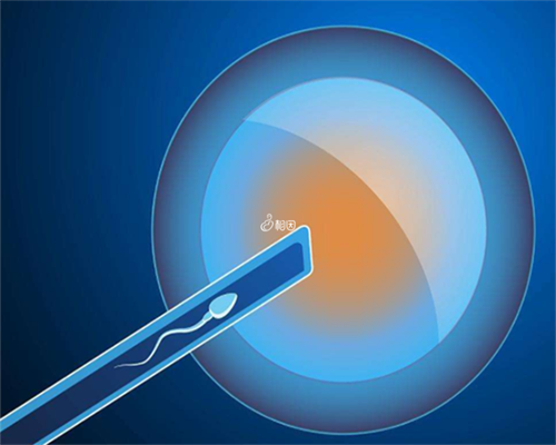 四川试管婴儿双胞胎,四川有私立机构可以做三代试管婴儿吗(费用高吗)