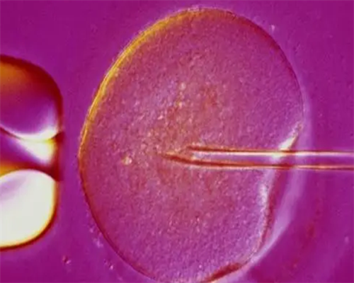 成都第一代孕网,成都西囡妇科试管 一促一移过程费用分享