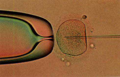 三代试管婴儿可以放几个胚胎