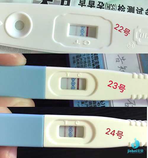 广安46岁试管婴儿生儿子的机率_多囊试管取卵过多怎么预防腹水？